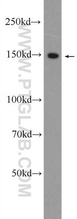 CPS1 Antibody in Western Blot (WB)