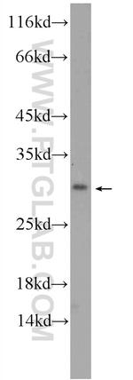 MAGIX Antibody in Western Blot (WB)
