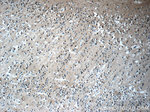 FBXO41 Antibody in Immunohistochemistry (Paraffin) (IHC (P))