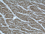 FBXO41 Antibody in Immunohistochemistry (Paraffin) (IHC (P))