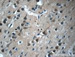 FBXO41 Antibody in Immunohistochemistry (Paraffin) (IHC (P))