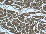 FBXO41 Antibody in Immunohistochemistry (Paraffin) (IHC (P))