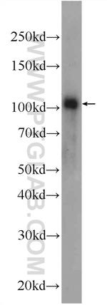 FBXO41 Antibody in Western Blot (WB)