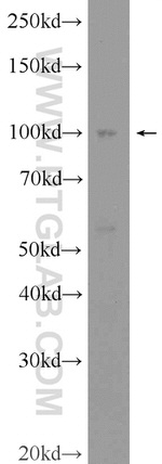FBXO41 Antibody in Western Blot (WB)