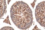 DHX57 Antibody in Immunohistochemistry (Paraffin) (IHC (P))