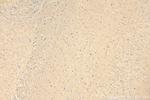 SYTL5 Antibody in Immunohistochemistry (Paraffin) (IHC (P))
