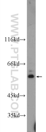ZNF140 Antibody in Western Blot (WB)