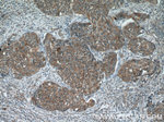 RNF25 Antibody in Immunohistochemistry (Paraffin) (IHC (P))