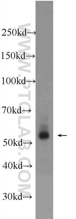 RNF25 Antibody in Western Blot (WB)