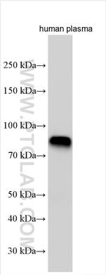 IGFALS Antibody in Western Blot (WB)