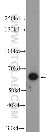 SHP1 Antibody in Western Blot (WB)