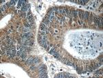 C8orf77 Antibody in Immunohistochemistry (Paraffin) (IHC (P))