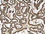 ENTPD7 Antibody in Immunohistochemistry (Paraffin) (IHC (P))