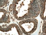 ENTPD7 Antibody in Immunohistochemistry (Paraffin) (IHC (P))
