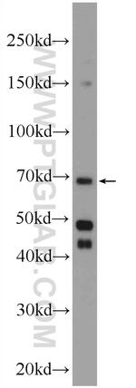 ENTPD7 Antibody in Western Blot (WB)