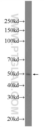 FYTTD1 Antibody in Western Blot (WB)