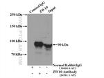 ZW10 Antibody in Immunoprecipitation (IP)