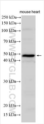 TBC1D13 Antibody in Western Blot (WB)