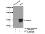 SUN1 Antibody in Immunoprecipitation (IP)