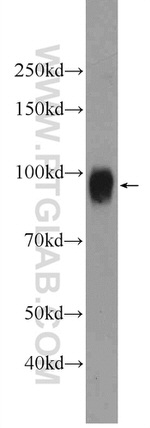 SUN1 Antibody in Western Blot (WB)