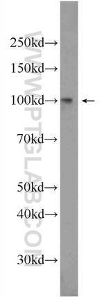 SUN1 Antibody in Western Blot (WB)
