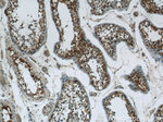 LRRC18 Antibody in Immunohistochemistry (Paraffin) (IHC (P))