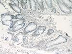 NF45 Antibody in Immunohistochemistry (Paraffin) (IHC (P))