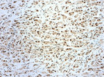 NF45 Antibody in Immunohistochemistry (Paraffin) (IHC (P))