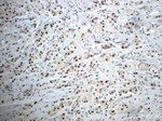 NF45 Antibody in Immunohistochemistry (Paraffin) (IHC (P))