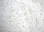 NF45 Antibody in Immunohistochemistry (Paraffin) (IHC (P))