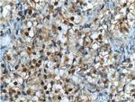 NR2F1 Antibody in Immunohistochemistry (Paraffin) (IHC (P))
