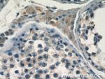 FAM133A Antibody in Immunohistochemistry (Paraffin) (IHC (P))