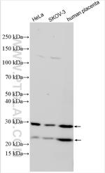 PGRMC2 Antibody in Western Blot (WB)