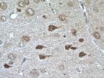 RIM1 Antibody in Immunohistochemistry (Paraffin) (IHC (P))