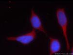 HEATR2 Antibody in Immunocytochemistry (ICC/IF)