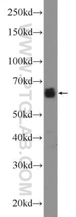 CCDC67 Antibody in Western Blot (WB)