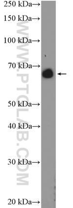 ANKRD34B Antibody in Western Blot (WB)