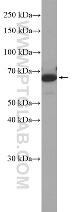 ANKRD34B Antibody in Western Blot (WB)