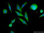 SLC37A1 Antibody in Immunocytochemistry (ICC/IF)