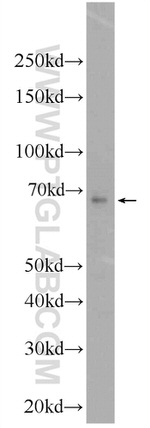 SLC37A1 Antibody in Western Blot (WB)