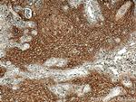 DSG1 Antibody in Immunohistochemistry (Paraffin) (IHC (P))