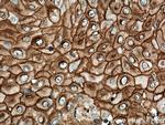 DSG1 Antibody in Immunohistochemistry (Paraffin) (IHC (P))