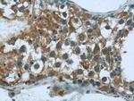 CEP85L Antibody in Immunohistochemistry (Paraffin) (IHC (P))