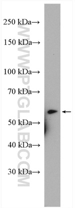 CEP85L Antibody in Western Blot (WB)