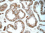 POTEA Antibody in Immunohistochemistry (Paraffin) (IHC (P))