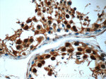 POTEA Antibody in Immunohistochemistry (Paraffin) (IHC (P))