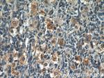 POTEA Antibody in Immunohistochemistry (Paraffin) (IHC (P))