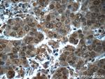 POTEA Antibody in Immunohistochemistry (Paraffin) (IHC (P))