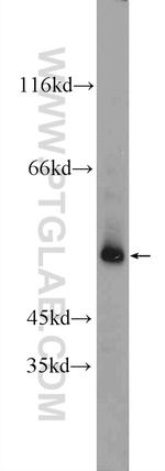 POTEA Antibody in Western Blot (WB)