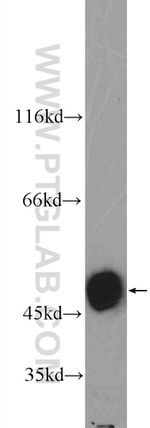 POTEA Antibody in Western Blot (WB)